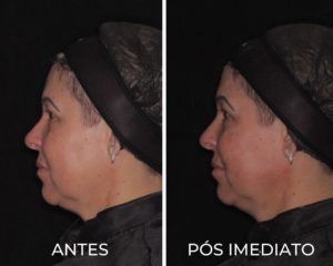 Royal Face Praia Grande Estética